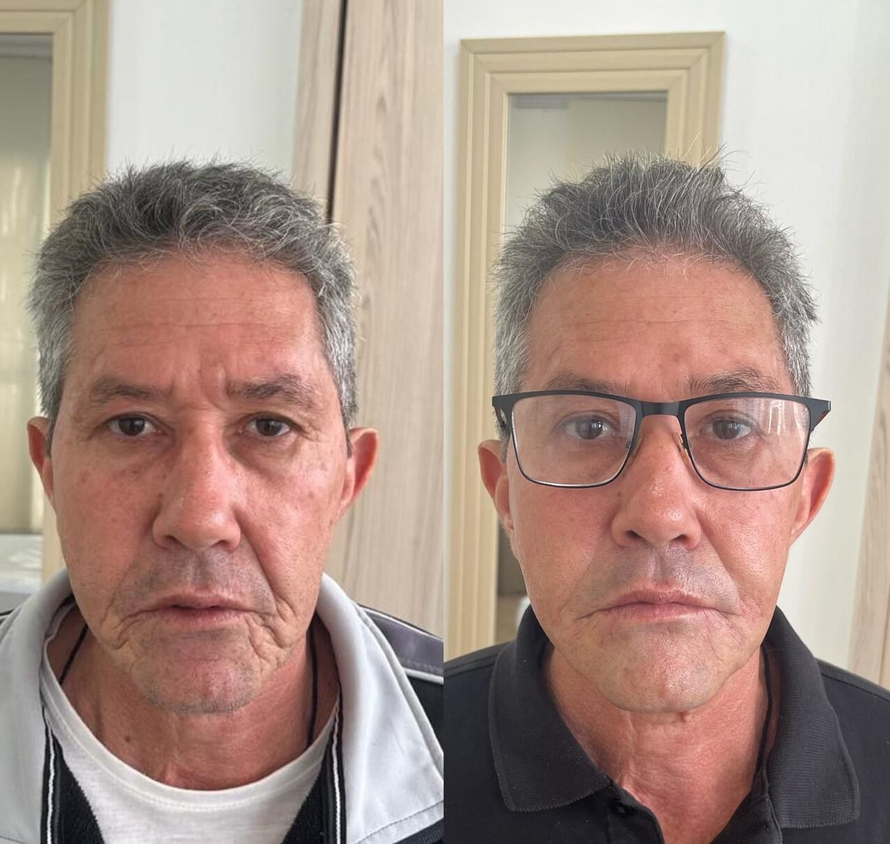 Bioestimulador-Masculino